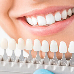 Teeth Whitening